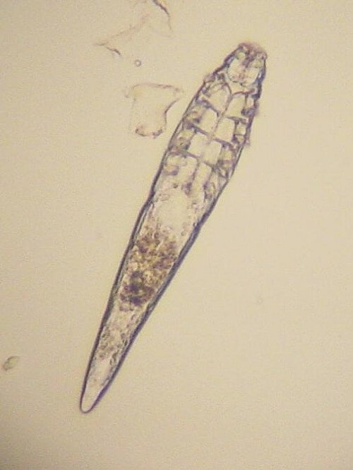 Das Foto einer unter dem Mikroskop vergrößerten Milbe.